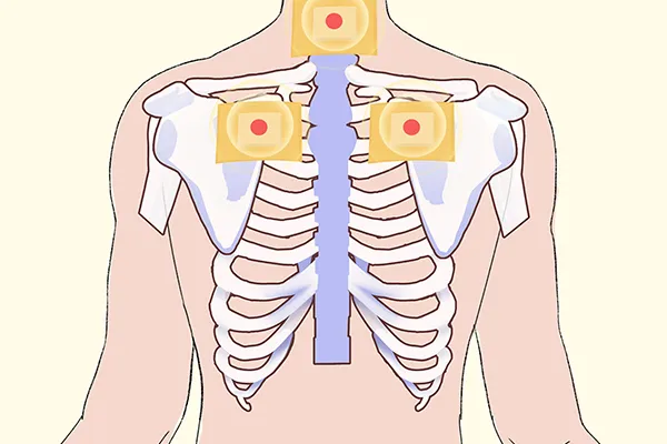 三九贴所贴部位(图2) 三九贴所贴部位