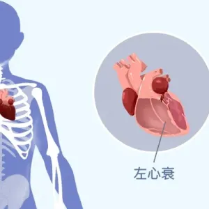 冠心病的症状表现在哪些方面