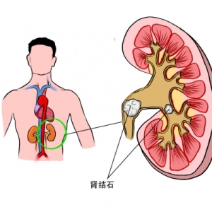 眼睛散光怎么办才能恢复