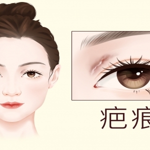 过敏性鼻炎的症状有哪些表现