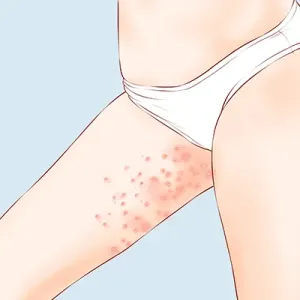 麻疹的传播途径